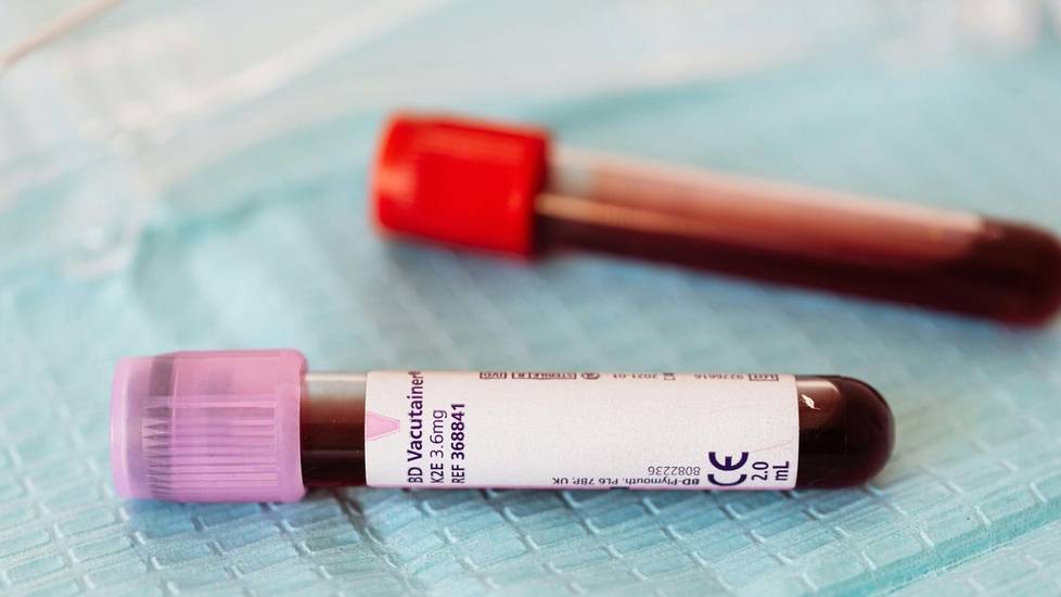 how to clean blood from scrubs