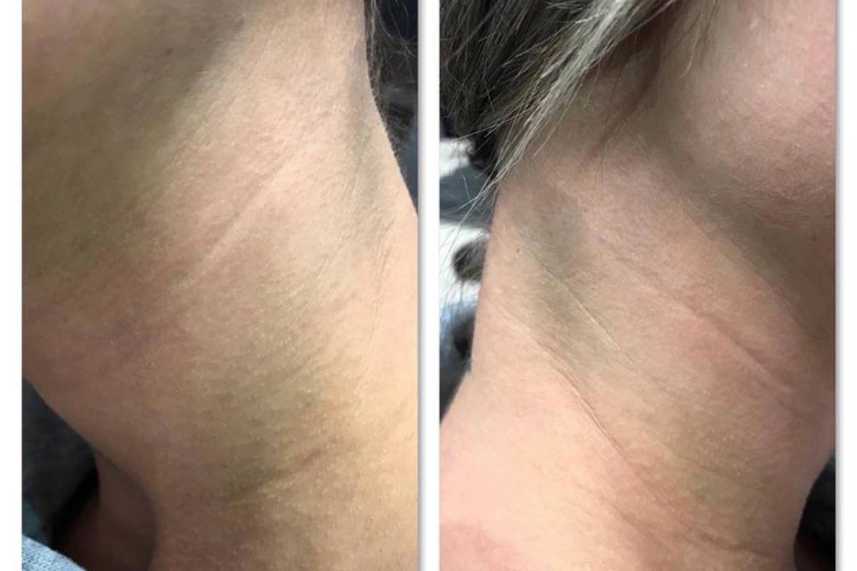Nurse’s Ear Lobe Bitten Off and Another Choked In Latest Patient Assaults