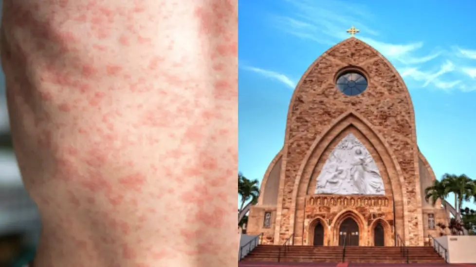 Fact Check: “50 Nursing Students” Measles Claim Is False—Florida School Outbreak Confirmed