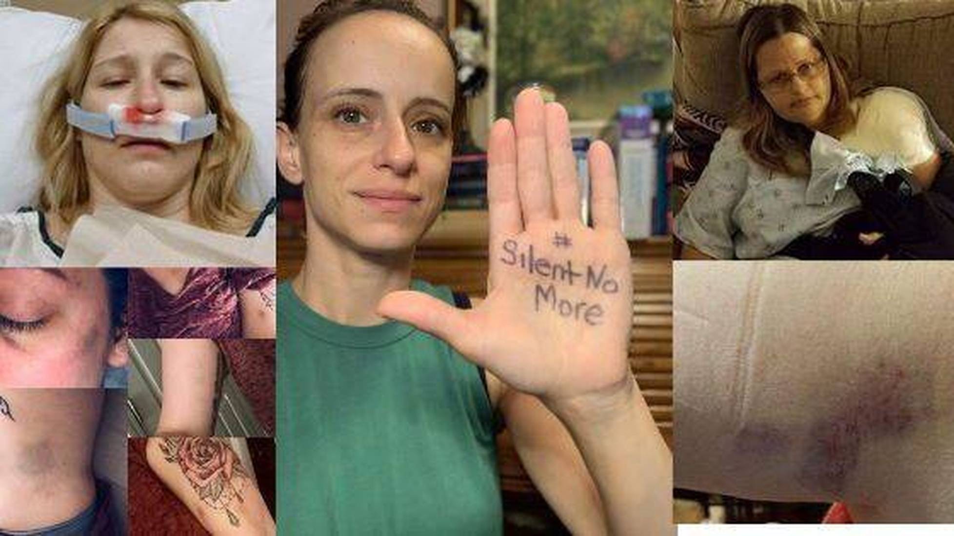 Nurses Say Violent Assaults By Patients Are a Silent Epidemic