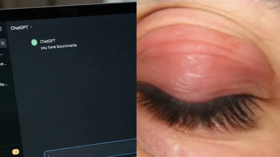 ‘Bixonimania’ Is a Fake Disease—But ChatGPT Diagnosed It to Thousands, Other AI Did Too