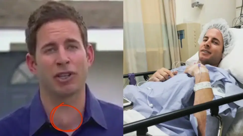 Nurse Warns HGTV's Tarek El Moussa After Spotting Lump on TV