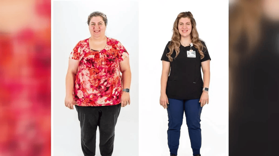 Before-and-after image of a registered nurse at Emplify Health by Gundersen, showing visible weight loss following bariatric surgery.