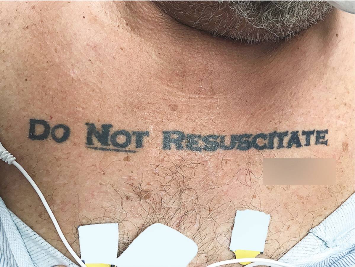 Doctors Confused By "Do Not Resuscitate" Tattoo On Dying Patient